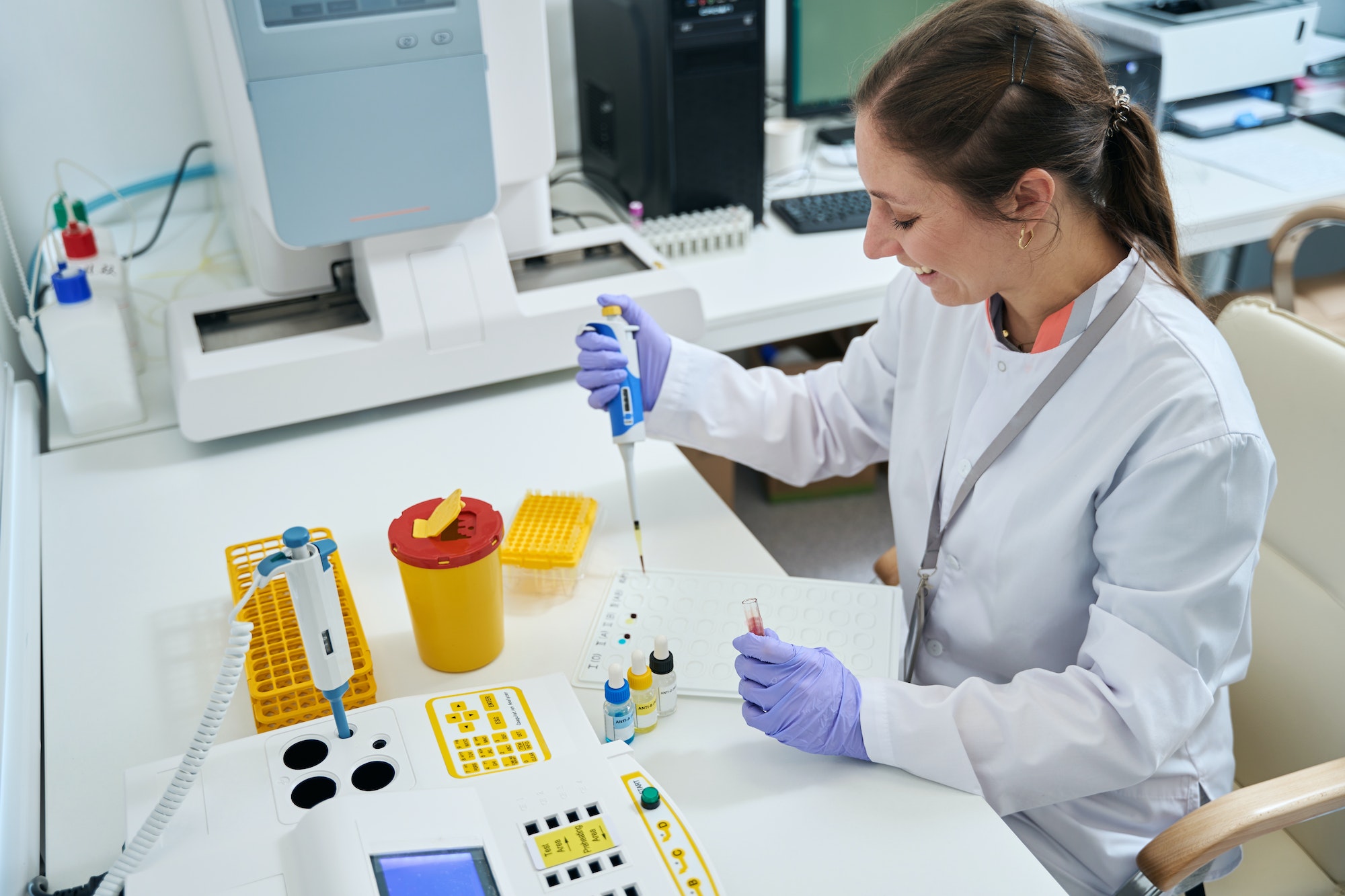 Female laboratory assistant conducts blood group test in testing unit