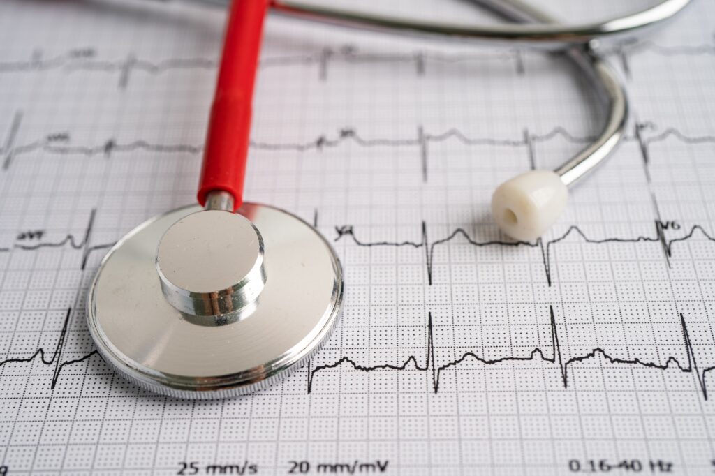 Stethoscope on electrocardiogram with red heart, heart wave, heart attack, cardiogram report.